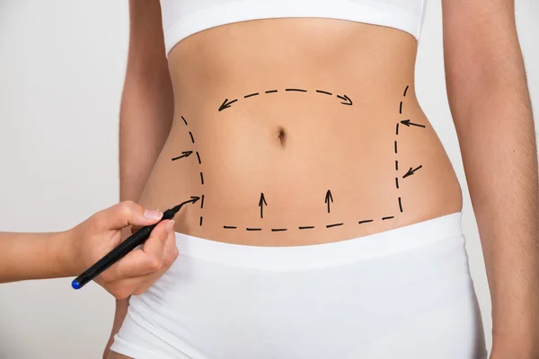 Abdominal Surgery 2