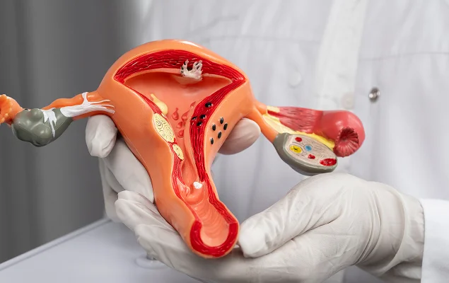 Photo of Vaginal operations 4