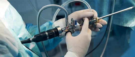 Photo of Cystoscopy 4
