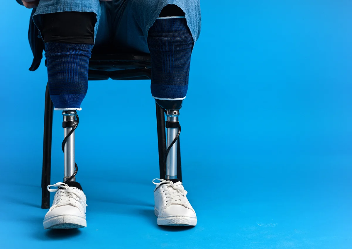Photo of Physical rehabilitation after joint replacement 1