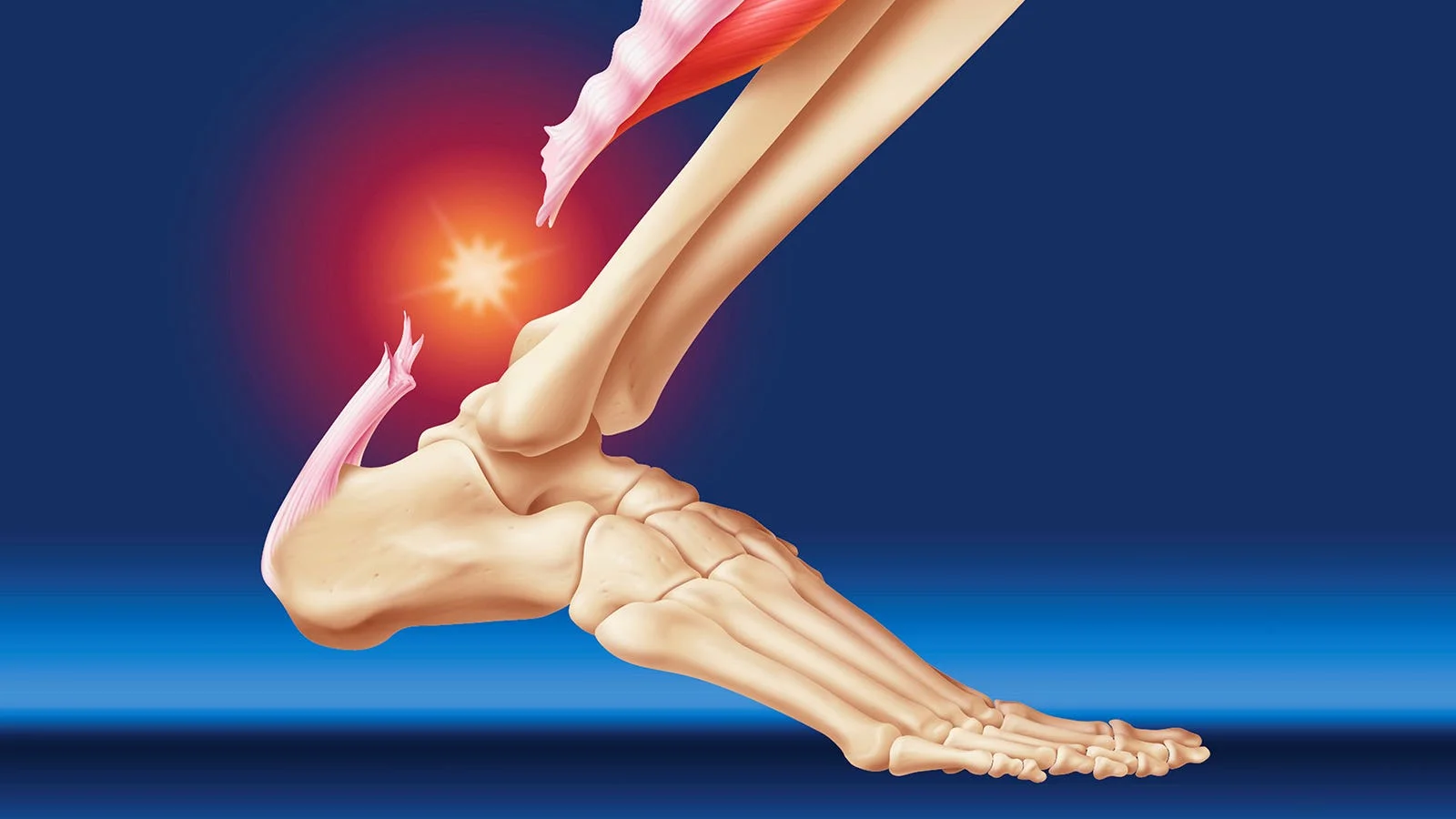 Photo of Surgical treatment of tendon rupture 1