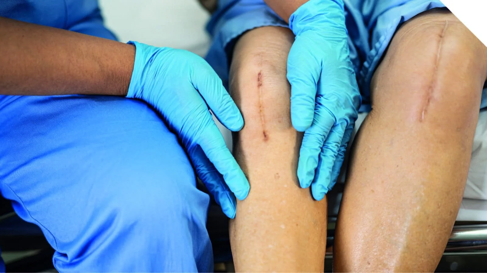 Photo of Surgical treatment of tendon rupture 3