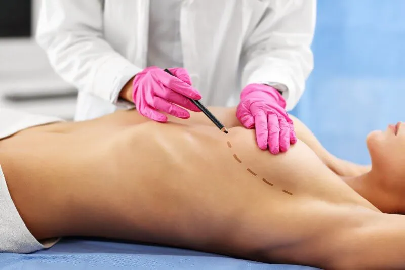 Surgery in mammology 1