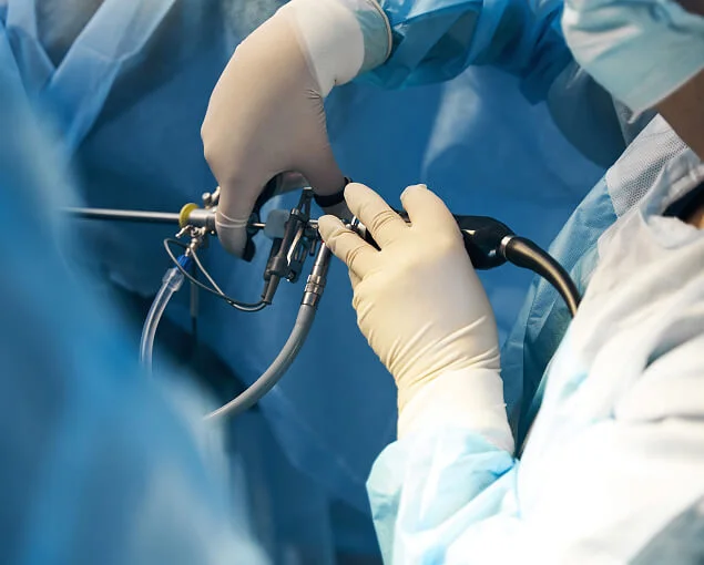 Photo of Surgical treatment of stomach ulcers in Dnipro 1