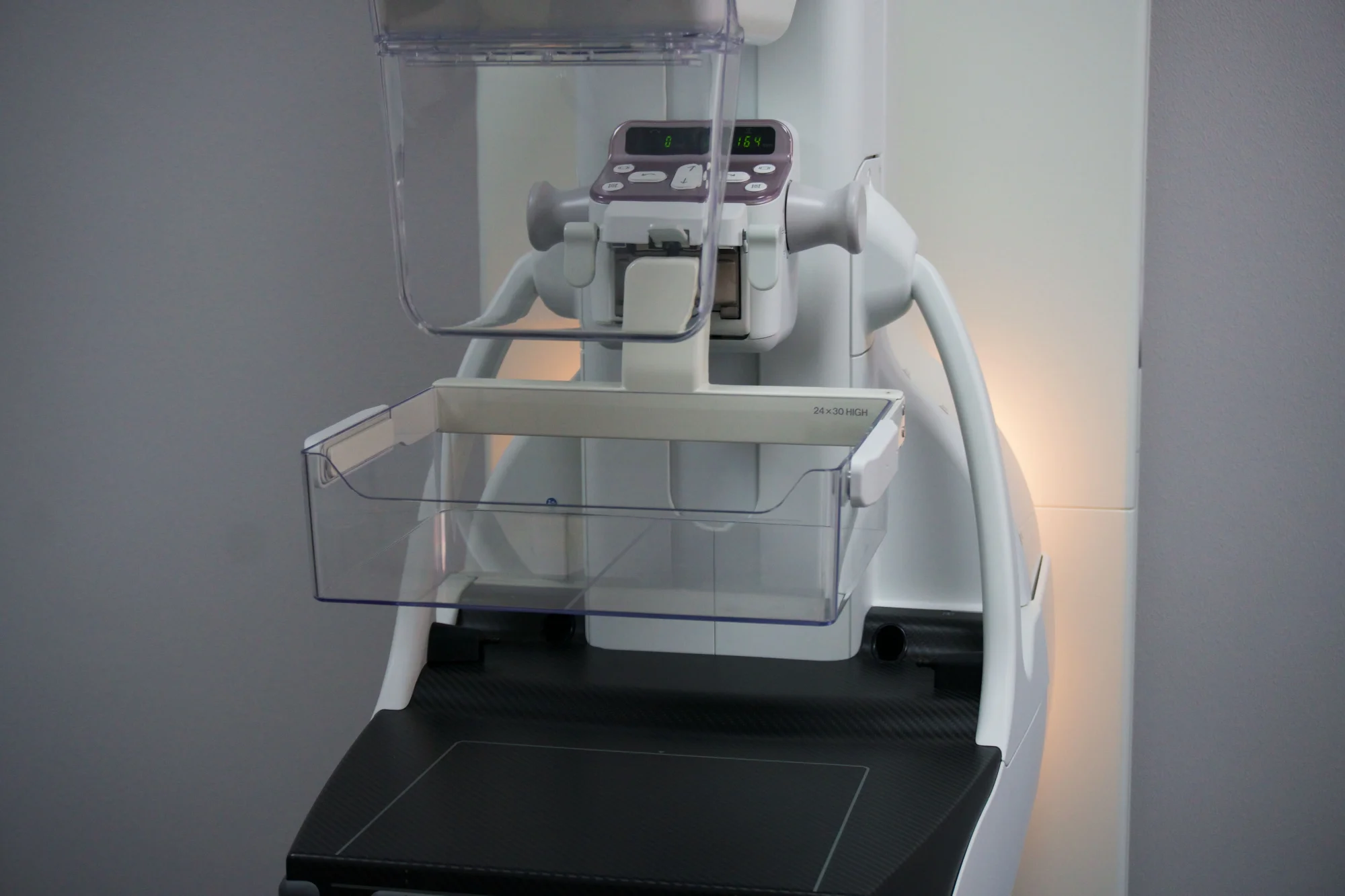 Photo of Breast tomosynthesis at Helyos Medical Centre 1