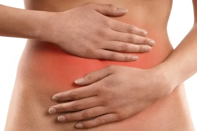 Photo of Uterine fibroids 4