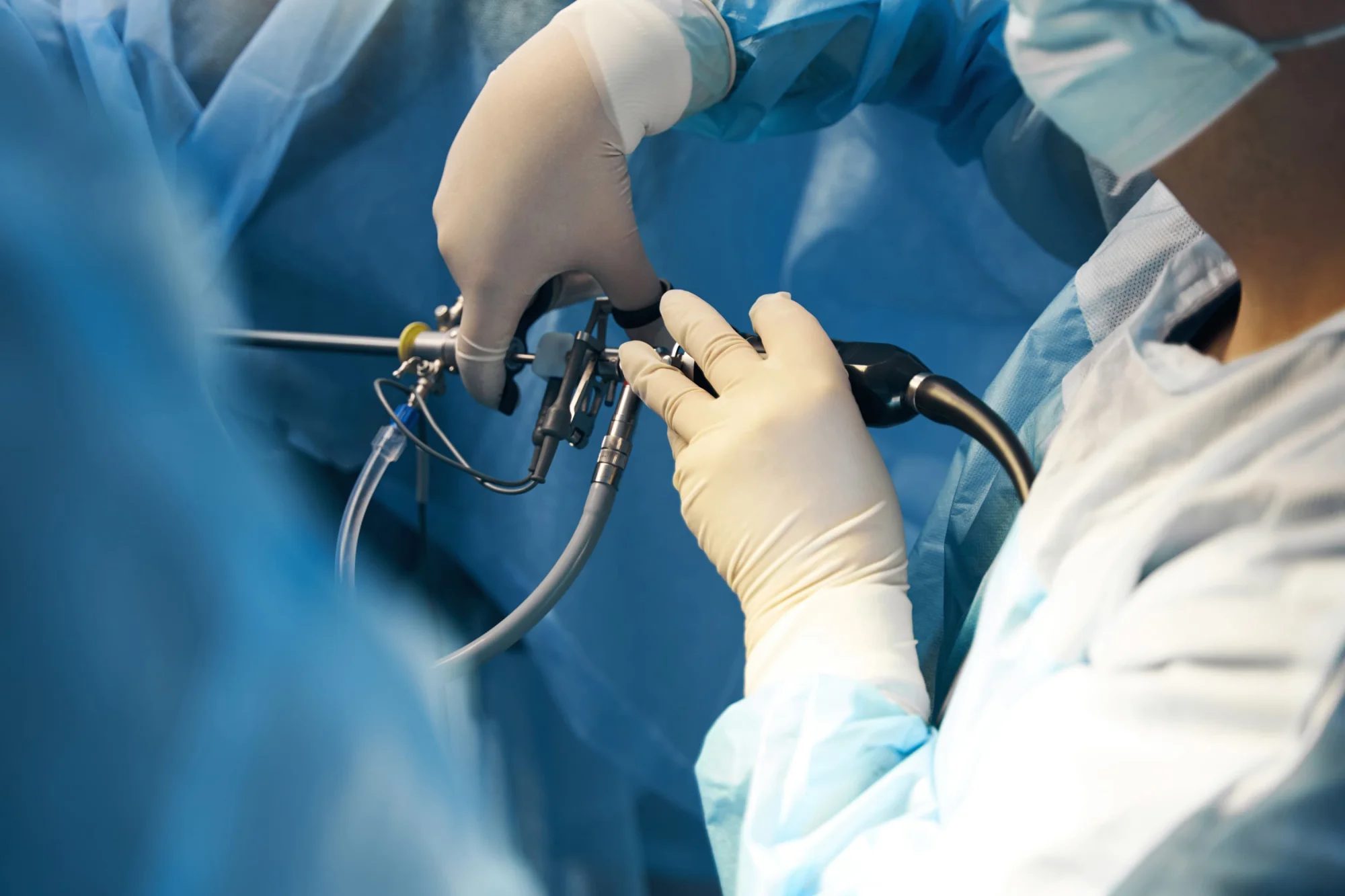 Photo of Gastrectomy. Stomach Cancer Removal in Dnipro 3